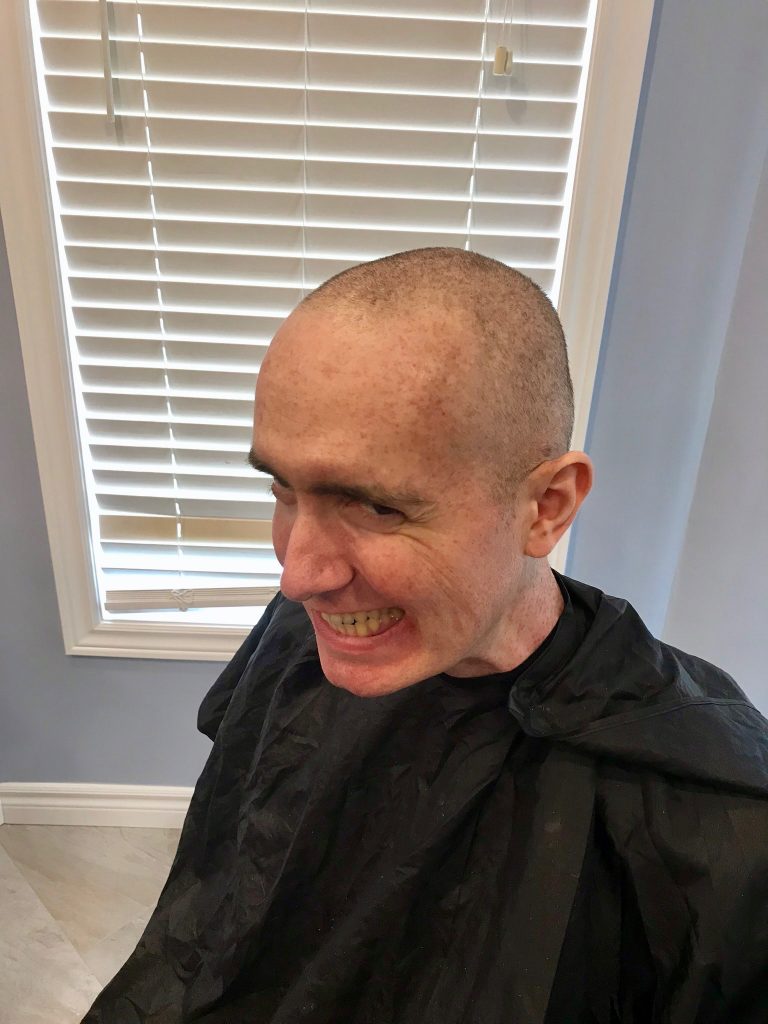 No hair John